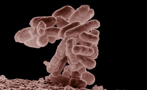 E. coli bacteria