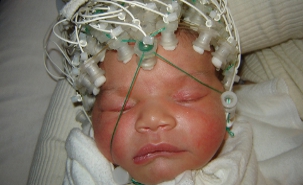 Researchers applied electrodes to babies heads to analyze their brain activity. Credit: Sainte-Justine University Hospital Research Centre. Researchers applied electrodes to babies heads to analyze their brain activity. Credit: Sainte-Justine University Hospital Research Centre.