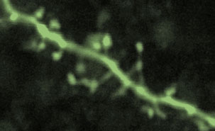 Image de dentrites observées dans le laboratoire de M.Araya.