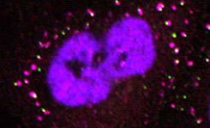 Cette image montre une cellule exposée à un stress oxydatif. Des granules de stress se forment dans le cytoplasme (en violet). La protéine TDP-43 contrôle la taille des granules de stress par la régulation d'une autre protéine nommée G3BP1.