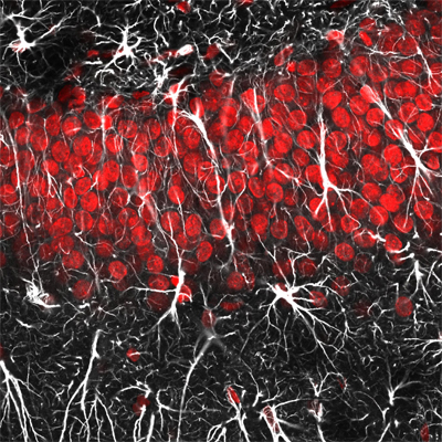 Astrocytes (en rouge) et neurones (en blanc). Crédit: Jason Snyder. Licence: CC BY 2.0. 