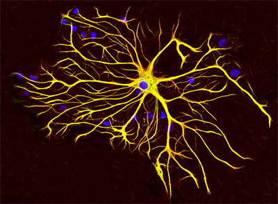 Une astrocyte. Crédit : GerryShaw. Licence CC BY-SA 3.0 